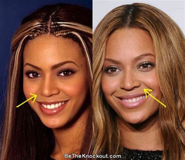 Discover Uncovered Truths And Captivating Insights About "Beyonce Boob Job"