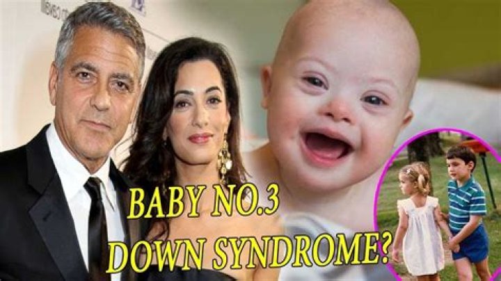 George Clooney And Down Syndrome Facts And Insights Revealed