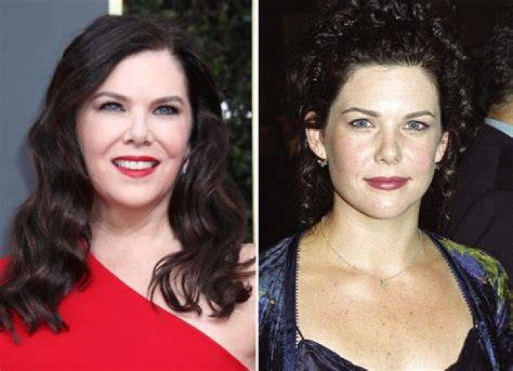 Lauren Graham's Plastic Surgery Journey: Unveiling The Transformation