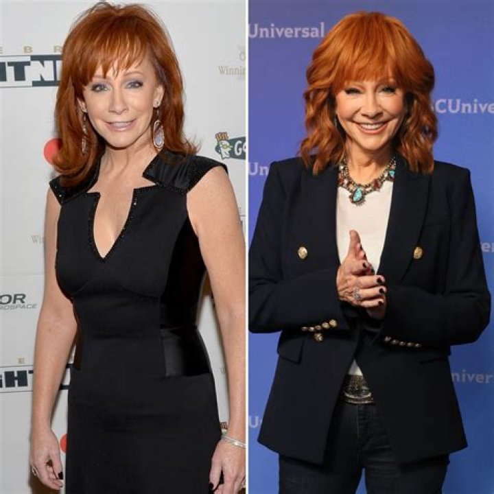Reba's Plastic Surgery Journey Unveiled
