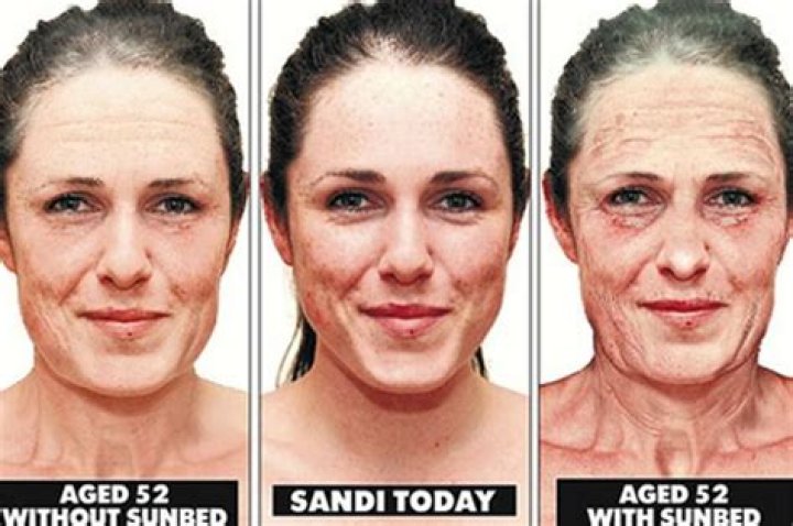 The Dangers Of Excessive Tanning Unveiled