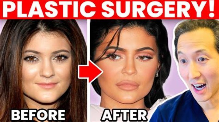 Uncovering Her Journey Before Plastic Surgery